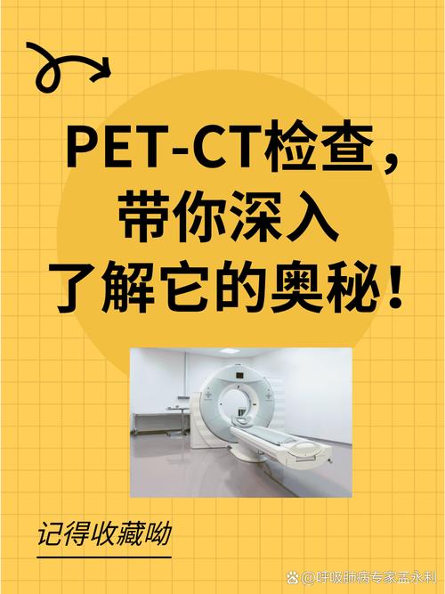 关于什么是pet一ct检查的信息